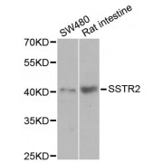 Western blot analysis of extracts of various cell lines, using SSTR2 antibody (abx002252) at 1/1000 dilution.