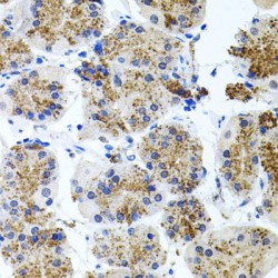 Somatostatin Receptor Type 2 (SSTR2) Antibody