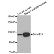 Western blot analysis of extracts of various cell lines, using DNMT3A antibody (abx002272).