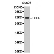 Western blot analysis of extracts of SW620 cells, using FSHR antibody (abx002275).