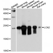 Western blot analysis of extracts of mouse testis, using LCN2 antibody (abx002278) at 1/1000 dilution.