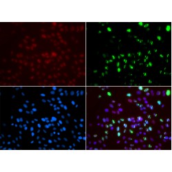 G/T Mismatch-Binding Protein (MSH6) Antibody