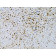 Immunohistochemistry of paraffin-embedded rat brain using NPY antibody (abx002280) at dilution of 1:75 (40x lens).