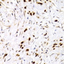 Cellular Tumor Antigen P53 (TP53) Antibody