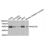 Western blot analysis of extracts of various cell lines, using RAD23A antibody (abx002288) at 1/1000 dilution.
