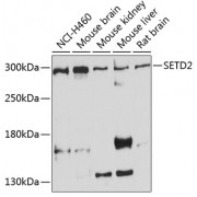 Western blot analysis of extracts of various cell lines, using SETD2 antibody (abx002294) at 1/1000 dilution.