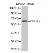 Western blot analysis of extracts of mouse brain, using SPHK2 antibody (abx002301).