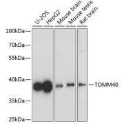 Western blot analysis of extracts of various cell lines, using TOMM40 antibody (1/1000 dilution).