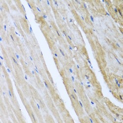 Calcium/calmodulin-Dependent Protein Kinase Type II Subunit Gamma (CAMK2G) Antibody