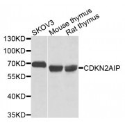 Western blot analysis of extracts of various cell lines, using CDKN2AIP antibody (abx002319) at 1/1000 dilution.
