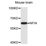 Western blot analysis of extracts of mouse brain, using NFIA antibody (abx002326) at 1/1000 dilution.