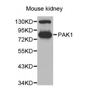Western blot analysis of extracts of mouse kidney, using PAK1 antibody (abx002331) at 1:700 dilution.