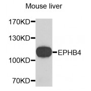 Western blot analysis of extracts of mouse liver, using EPHB4 antibody (abx002341) at 1/1000 dilution.