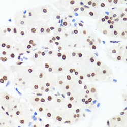 Histone H1.0 (H1F0) Antibody