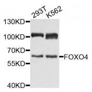Western blot analysis of extracts of various cell lines, using FOXO4 antibody (abx002354) at 1/1000 dilution.