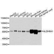 Western blot analysis of extracts of various cell lines, using ALDH6A1 antibody (abx002356) at 1/1000 dilution.