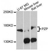 Western blot analysis of extracts of various cell lines, using PZP antibody (abx002369) at 1:3000 dilution.