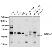 Western blot analysis of extracts of various cell lines, using SLC39A7 antibody (abx002387) at 1/1000 dilution.