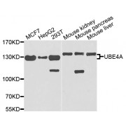Western blot analysis of extracts of various cell lines, using UBE4A antibody (abx002394) at 1/1000 dilution.