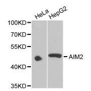 Western blot analysis of extracts of various cell lines, using AIM2 antibody (abx002396) at 1/1000 dilution.