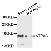 Western blot analysis of extracts of various cell lines, using ATP8A1 antibody (abx002408) at 1/1000 dilution.