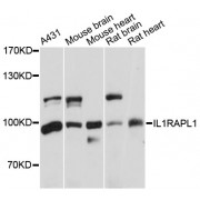 Western blot analysis of extracts of various cell lines, using IL1RAPL1 antibody (abx002415) at 1:3000 dilution.
