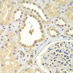 Zinc Finger Protein 346 (ZNF346) Antibody