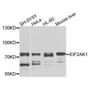 Western blot analysis of extracts of various cell lines, using EIF2AK1 antibody (abx002449) at 1/1000 dilution.