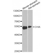 Western blot analysis of extracts of various cell lines, using CHIA antibody (abx002450) at 1/1000 dilution.