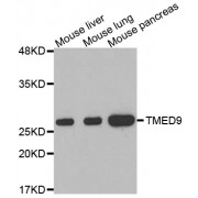 Western blot analysis of extracts of various cell lines, using TMED9 antibody (abx002470).