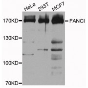 Western blot analysis of extracts of various cell lines, using Fanconi Anemia Group I Protein (FANCI) antibody (abx002475) at 1/1000 dilution.