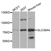 Western blot analysis of extracts of various cell lines, using SLC39A4 antibody (abx002482) at 1/1000 dilution.