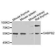 Western blot analysis of extracts of various cell lines, using GABPB2 antibody (abx002556) at 1/1000 dilution.