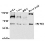 Western blot analysis of extracts of various cell lines, using RNF168 antibody (abx002568) at 1/1000 dilution.