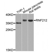 Western blot analysis of extracts of various cell lines, using RNF212 antibody (abx002581) at 1/1000 dilution.