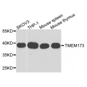 Western blot analysis of extracts of various cell lines, using TMEM173 antibody (abx002586) at 1/1000 dilution.