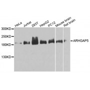 Western blot analysis of extracts of various cell lines, using ARHGAP5 antibody (abx002596) at 1/1000 dilution.