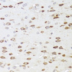 Rho GTPase Activating Protein 5 (ARHGAP5) Antibody