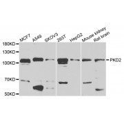 Western blot analysis of extracts of various cell lines, using PKD2 antibody (abx002617) at 1/1000 dilution.