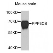 Western blot analysis of extracts of mouse brain, using PPP3CB antibody (abx002621) at 1/1000 dilution.