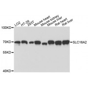 Western blot analysis of extracts of various cell lines, using SLC16A2 antibody (abx002625) at 1:3000 dilution.
