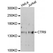 Western blot analysis of extracts of various cell lines, using CTR9 antibody (abx002638) at 1/1000 dilution.