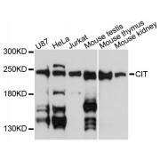 Western blot analysis of extracts of various cell lines, using CIT antibody (abx002644) at 1:3000 dilution.
