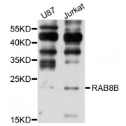 Western blot analysis of extracts of various cell lines, using RAB8B antibody (abx002652) at 1/1000 dilution.