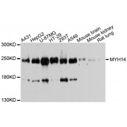Western blot analysis of extracts of various cell lines, using MYH14 antibody (abx002659) at 1/1000 dilution.