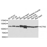 Western blot analysis of extracts of various cell lines, using ACTN2 antibody (abx002676) at 1/1000 dilution.