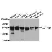 Western blot analysis of extracts of various cell lines, using ALDH1B1 antibody (abx002680) at 1/1000 dilution.