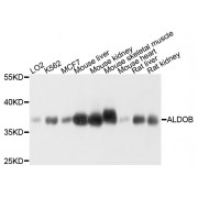 Western blot analysis of extracts of various cell lines, using ALDOB antibody (abx002683) at 1/1000 dilution.