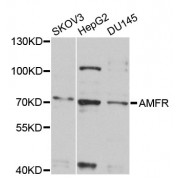 Western blot analysis of extracts of various cell lines, using AMFR antibody (abx002685) at 1/1000 dilution.