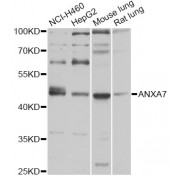 Western blot analysis of extracts of various cell lines, using ANXA7 antibody (abx002687) at 1/1000 dilution.